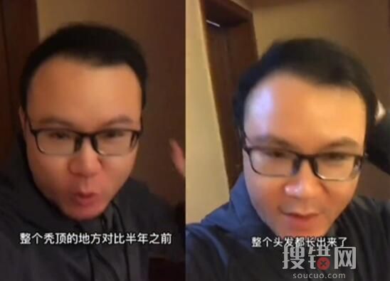 男子回应“不用洗发水变满头黑发” 为什么引争议？