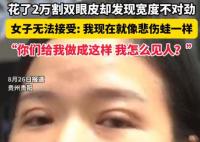 女子花2万割双眼皮控诉成了悲伤蛙 到底是什么情况？